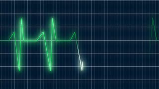Oscilloscope, Electronic Equipment, Equipment, Technology, Digital, Graphic