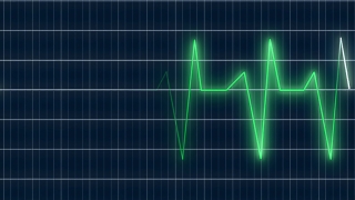 Oscilloscope, Electronic Equipment, Equipment, Graphic, Digital, Technology