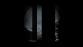 X-ray Film, Film, Texture, Design, Space, Photographic Paper
