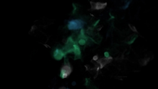 Jellyfish, Invertebrate, Animal, Light, Wallpaper, Graphic